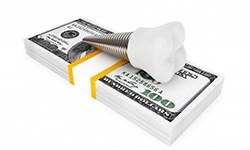 Model implant on money representing the cost of dental implants in Frisco