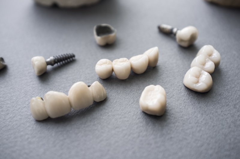 A series of dental restorations.