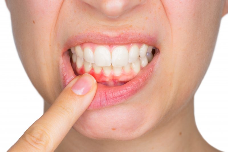 A woman with gum disease.