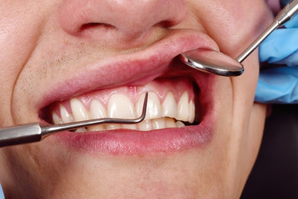 Patient at dentist having their gums inspected.