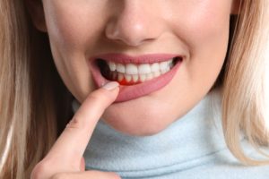 Lower half of a woman's face in a gray turtleneck, pulling her bottom lip down with her pointer finger to reveal her gums