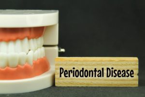 “Periodontal disease” sign next to dental model