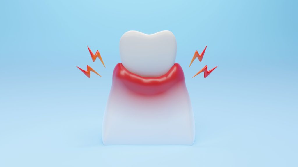 Getting Around Gum Disease 3 Questions to Ask Your Periodontist Dr