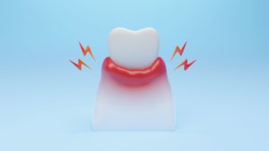 Illustration of a tooth in an inflamed gum with a light blue background