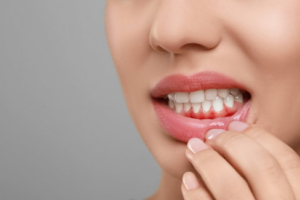 Woman pulling her lower lip to reveal red, swollen gums